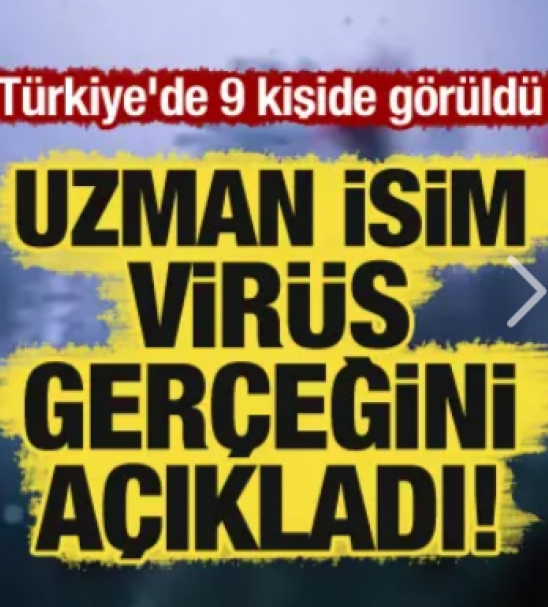 Uzman isim virs gereini aklad! Trkiye'de 9 kiide grld